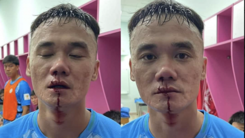 HLV Trần Duy Quang của CLB Trẻ TP.HCM: Vụ việc đánh nhau có 'VAR' ghi lại, mọi người đều nhận thấy đúng sai 