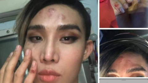 Bị tố đánh người mẫu trên phố, tài xế GoViet thanh minh: “Khách quá xấc xược”