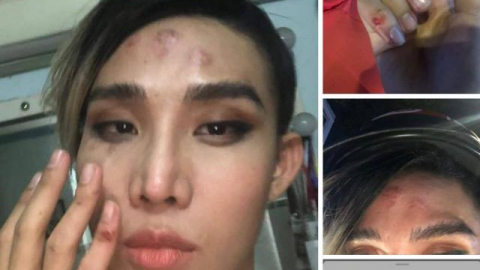 GoViet lên tiếng vụ người mẫu MiD Nguyễn tố bị tài xế hành hung