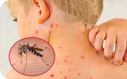 Dịch sốt xuất huyết nóng từng ngày, các địa phương 'khóc ròng' vì thiếu thuốc