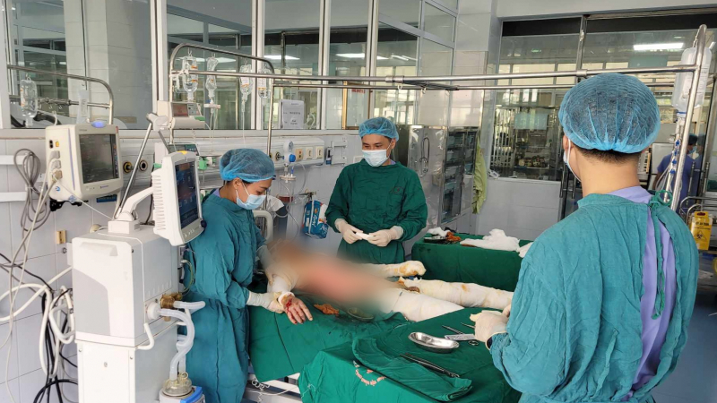 Vụ nghi nổ khí gas ở Vĩnh Phúc: 3 nạn nhân bị bỏng rất nặng, tiên lượng dè dặt 
