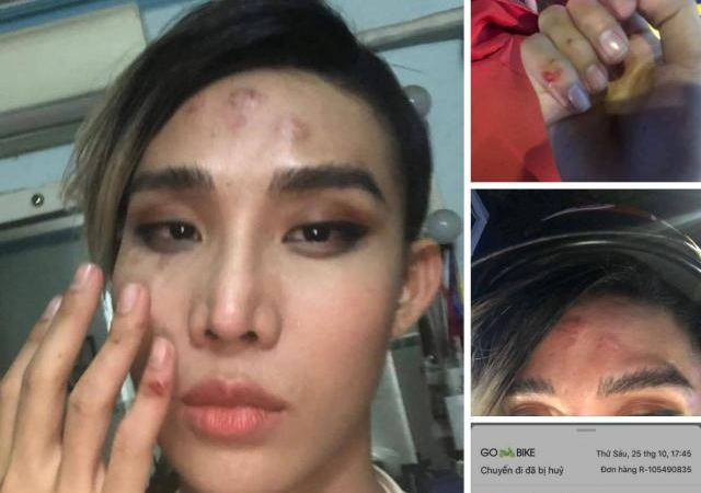 Bị tố đánh người mẫu trên phố, tài xế GoViet thanh minh: “Khách quá xấc xược”