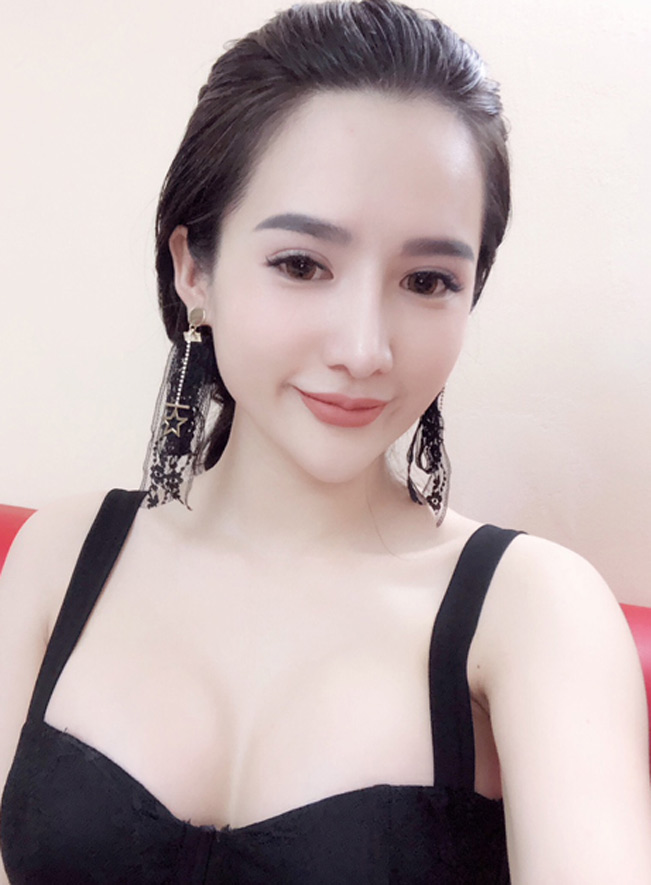 Nguyễn Đình Nhi trước và sau khi phẫu thuật thẩm mỹ. Ảnh: NVCC. Nguyễn Đình Nhi trước và sau khi phẫu thuật thẩm mỹ. Ảnh: NVCC.