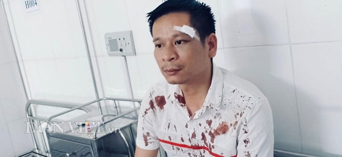 vu cty “boc bat ho” bat, danh nguoi: hang loat nan nhan khac len tieng hinh anh 2