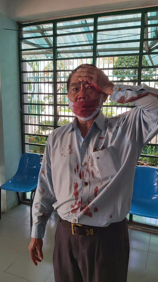 Bất ngờ với vụ phó trưởng phòng Cơ sở tư vấn và cai nghiện ma túy Bình Triệu tố bị đánh hội đồng - Ảnh 1.