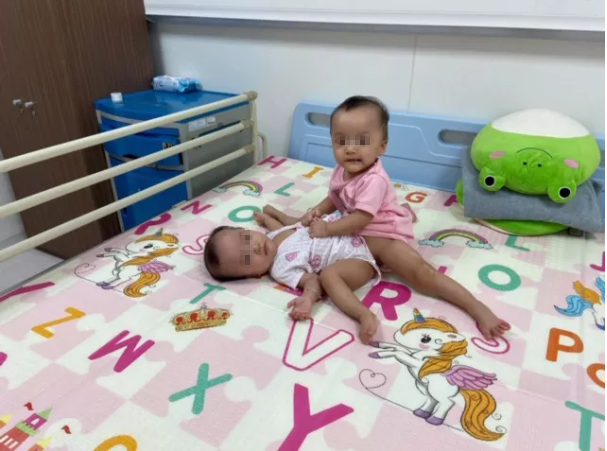 Những hình ảnh đầu tiên của ca phẫu thuật tách hai bé gái song sinh - Ảnh 1.