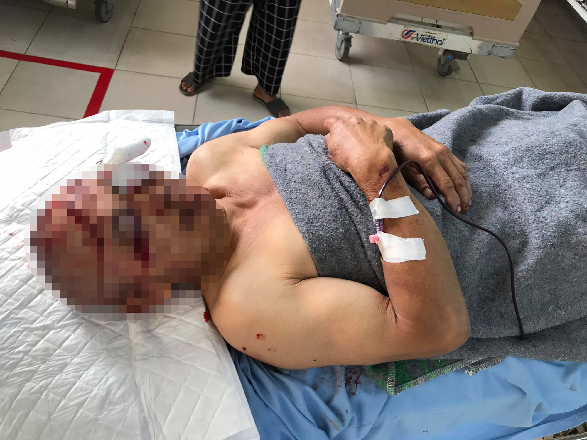 Đạp xe đạp từ Sài Gòn lên Đà Lạt chém người nguy kịch, cướp tài sản - Ảnh 1.