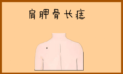 5 nốt ruồi đại phú đại quý, ai sở hữu thì càng có tuổi lại càng giàu sang, sung túc - Ảnh 1.