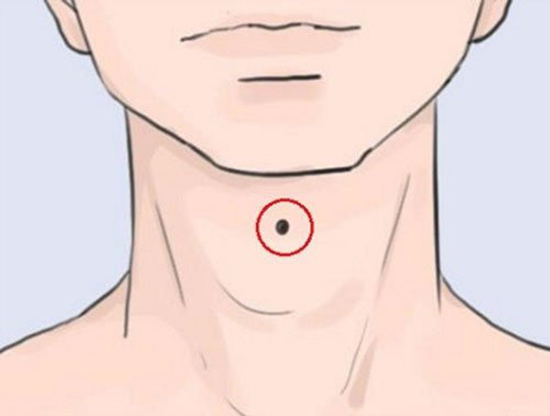 4 nốt ruồi &quot;hút lộc&quot; của đàn ông, quyền lực, tiền bạc đủ cả - Ảnh 1.
