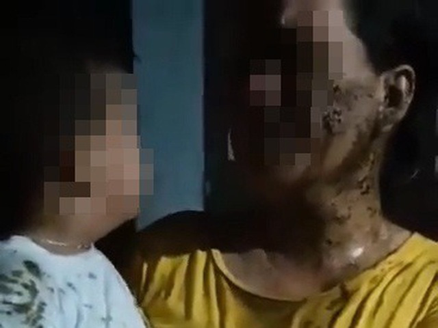 Phú Yên: Xem xét khởi tố vụ mẹ con bé trai 2 tuổi bị đổ phân bẩn khắp người - Ảnh 1.