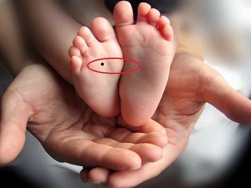5 nốt ruồi ẩn chứa tài lộc, vượng vận quý nhân, 10 người có thì 9 người giàu sang, sung túc - Ảnh 2.