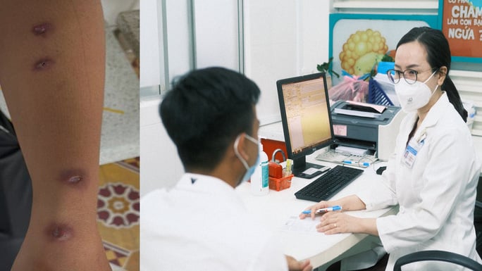 Bị lao da qua vết xước nhỏ do tôm đâm - Ảnh 1.