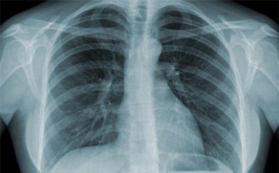 8 đại dịch kinh hoàng giết chết nhiều người nhất trong lịch sử - Ảnh 11.