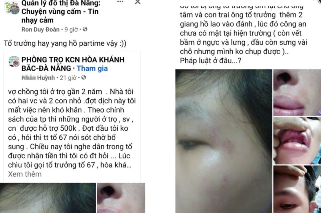 TIN NÓNG 24 GIỜ QUA: Bác sĩ trưởng khoa là F1 trốn cách ly về nhà; nam thanh niên đâm chết người tình hơn tuổi - Ảnh 5.