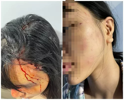 Công an điều tra vụ siêu mẫu Khả Trang tố cáo bị chồng sắp hành hung - Ảnh 1.