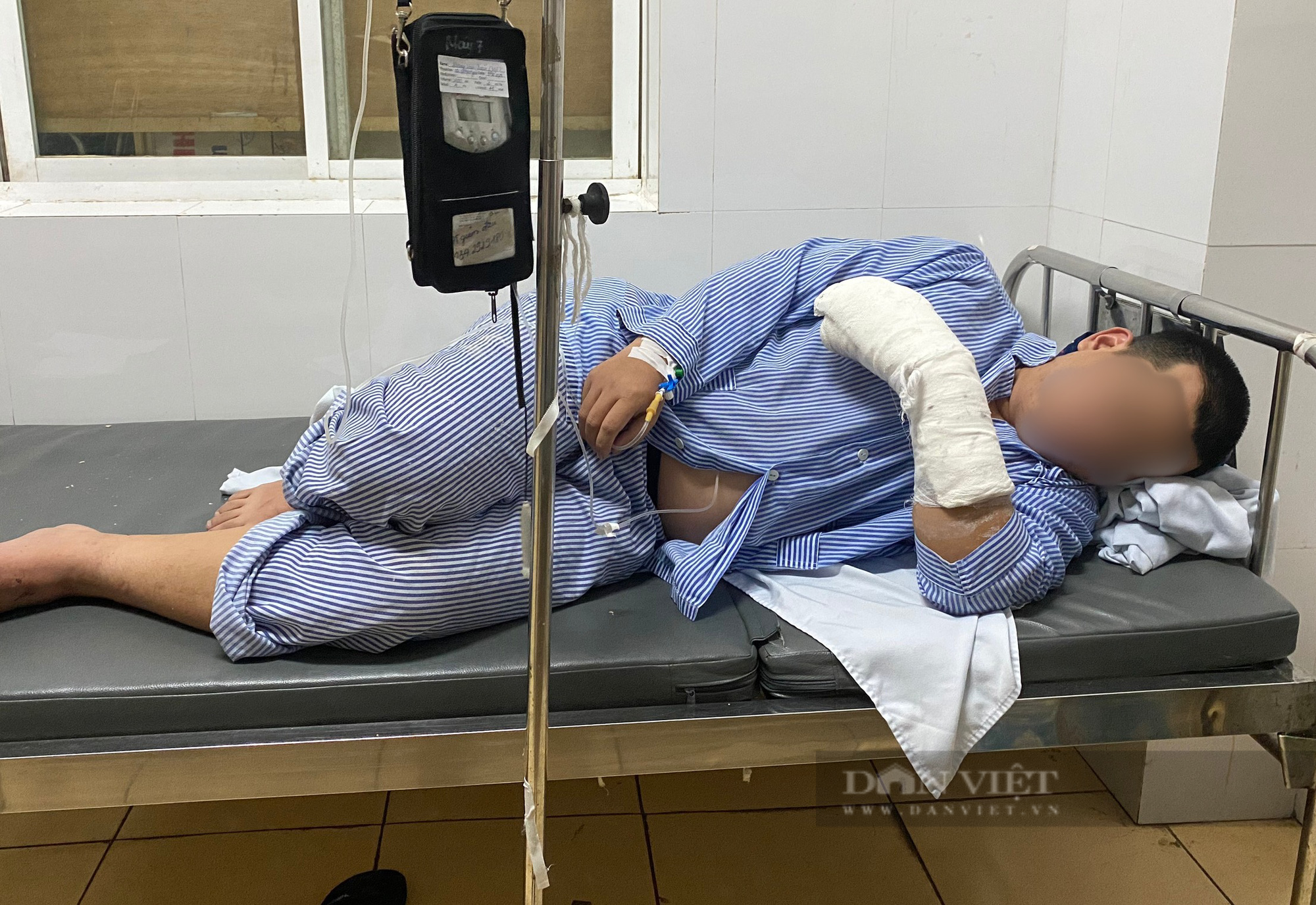 Hà Nội: Đã xác định nhóm đối tượng cầm dao phóng chém đứt gân tay người dân trong đêm - Ảnh 1.