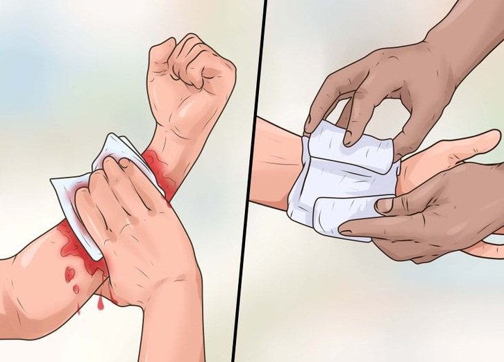 Từ vụ nữ bác sĩ thú y qua đời vì vết cắn của thú cưng, chuyên gia chỉ rõ cần làm ngay việc này - Ảnh 2.