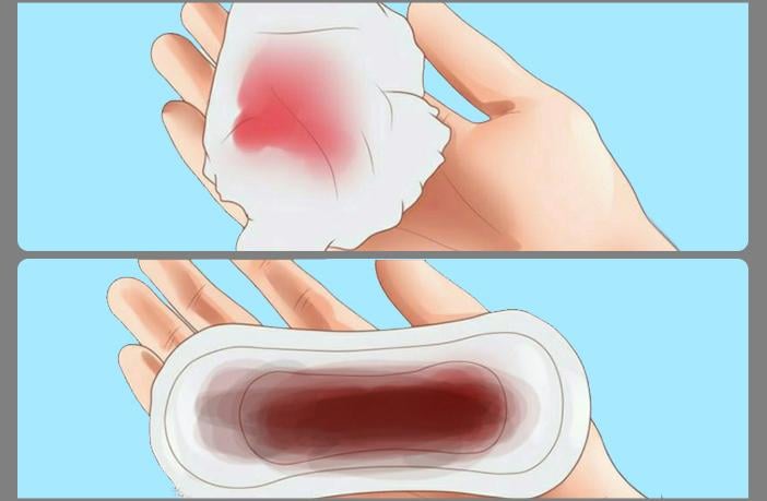 Nhận biết dấu hiệu u xơ tử cung và giải pháp cải thiện từ Nga Phụ Khang - Ảnh 1.