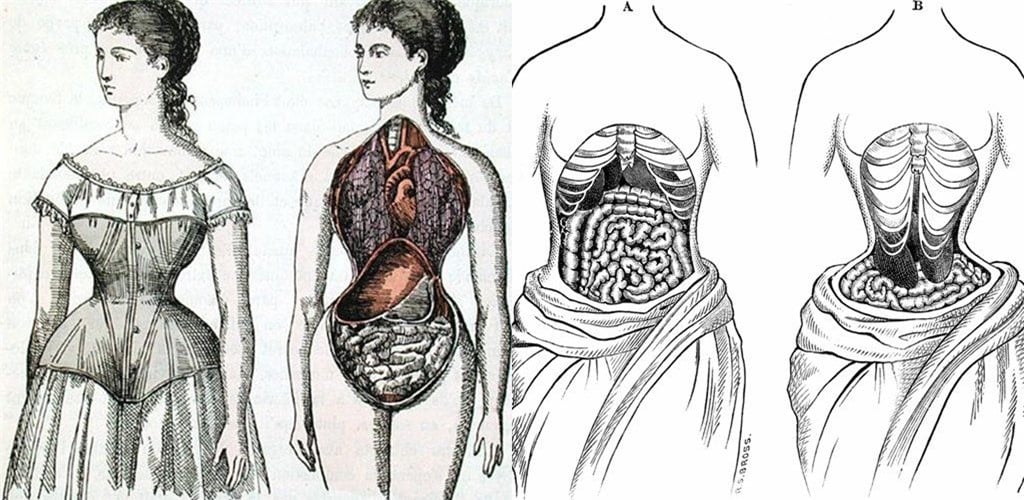 Rợn tóc gáy với những tiêu chuẩn làm đẹp của phụ nữ cổ xưa  - Ảnh 3.