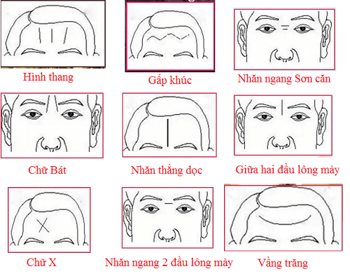 Người có 1 trong 5 nếp nhăn ở vị trí này vượng tài lộc, cuộc sống giàu sang - Ảnh 1.