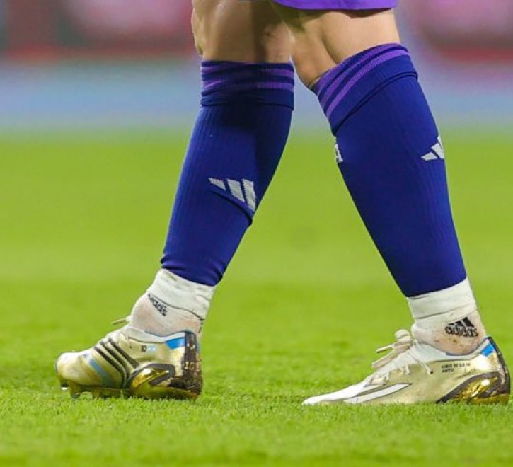 Hình ảnh mắt cá chân Messi sưng to và điều chưa biết phía sau - Ảnh 2.
