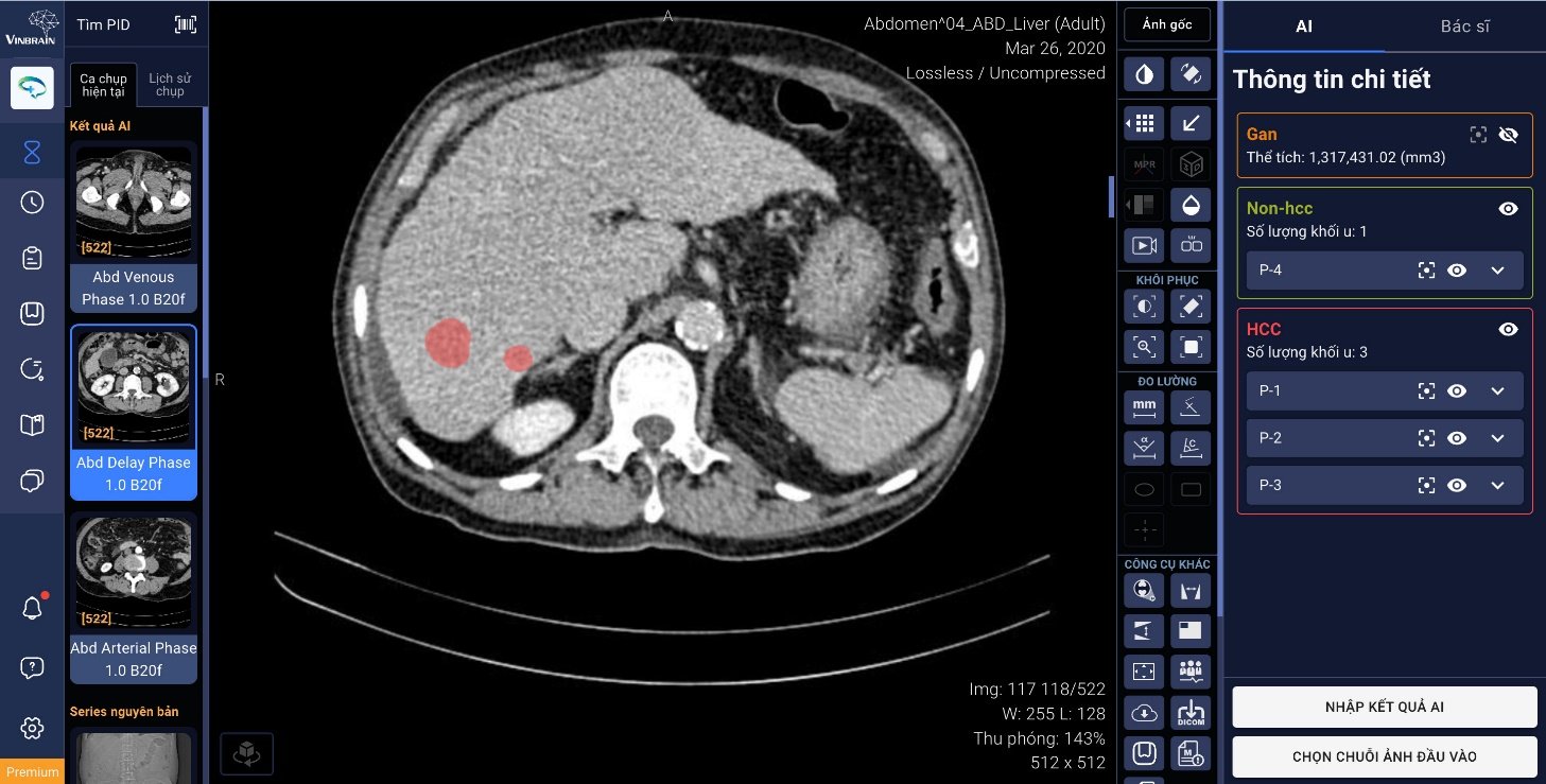 VINBRAIN cùng Bệnh viện Đại học Y Dược TP.HCM phát triển ứng dụng AI phát hiện, chẩn đoán ung thư gan - Ảnh 1.