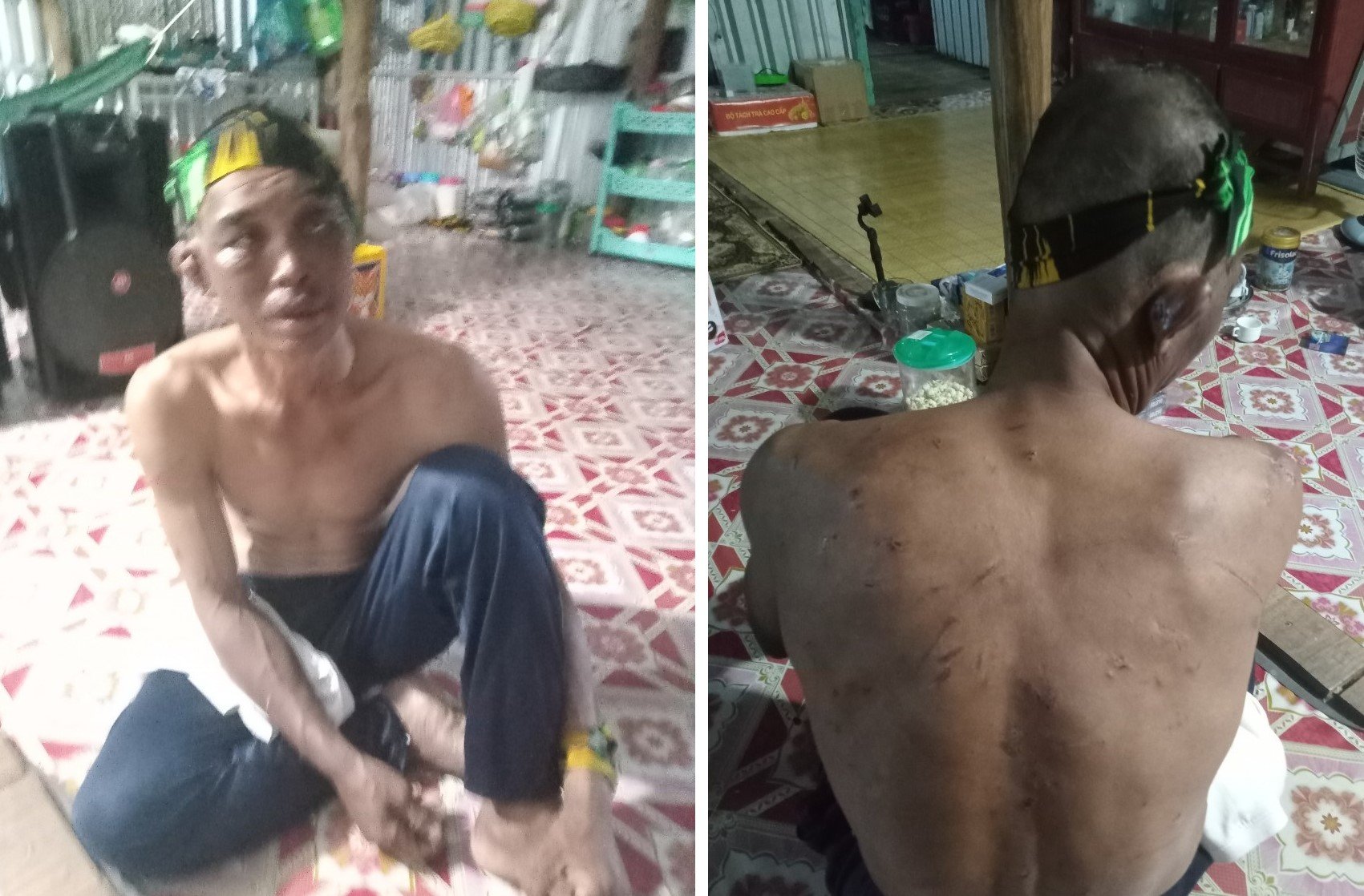 Vụ người đàn ông bị hành hạ dã man trên tàu cá: Bắt người chiếm đoạt tiền bồi thường - Ảnh 2.