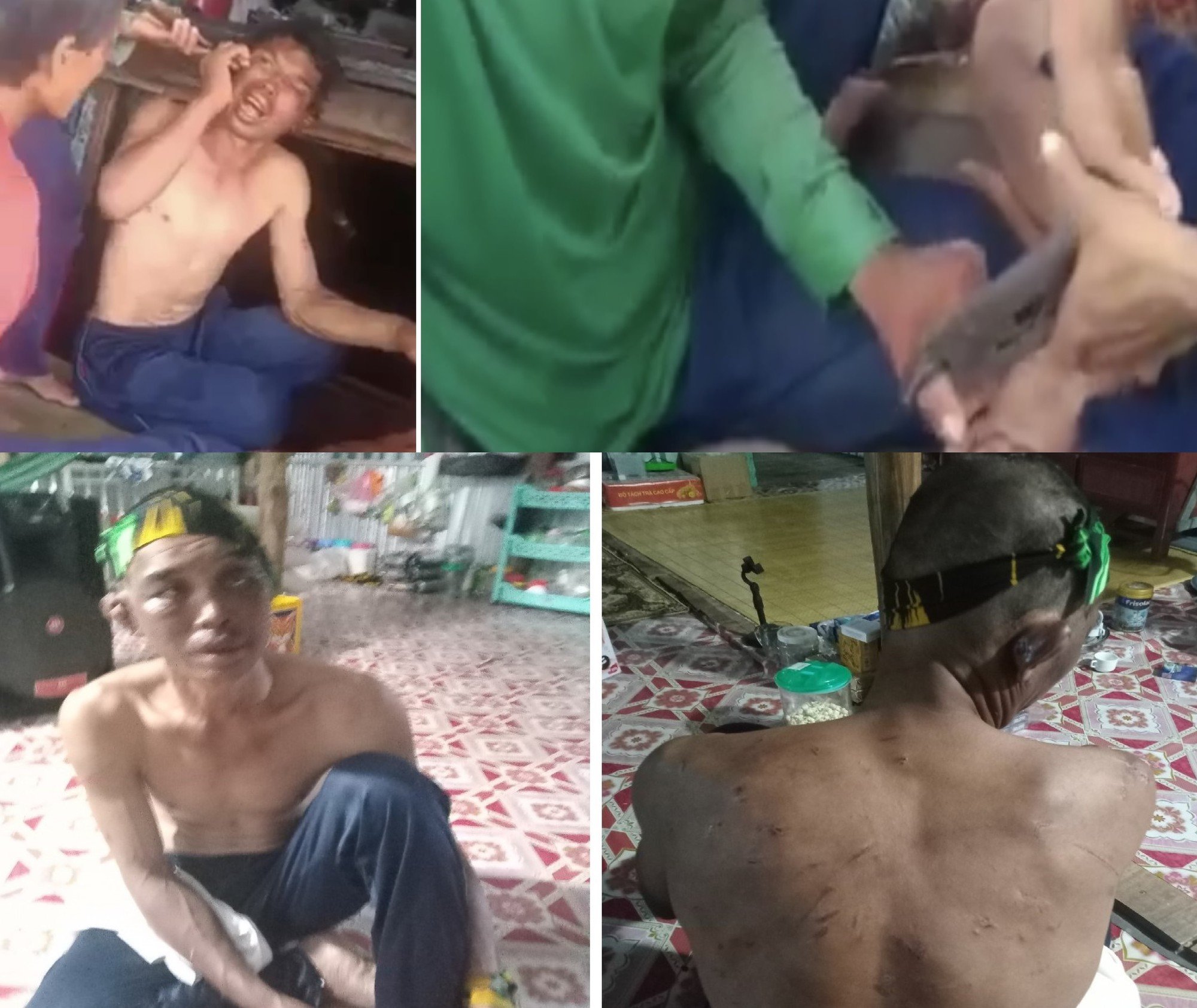 Vụ người đàn ông bị hành hạ dã man trên tàu cá ở Cà Mau: Luật sư hỗ trợ pháp lý miễn phí - Ảnh 2.