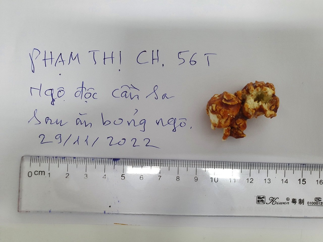 Ăn bỏng ngô đặt mua trên mạng, một phụ nữ ngộ độc cần sa  - Ảnh 1.