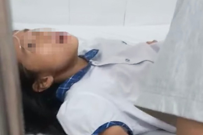 Hai học sinh lớp 6 co giật, khó thở sau khi ăn kẹo của người lạ: Thông tin mới nhất - Ảnh 1.