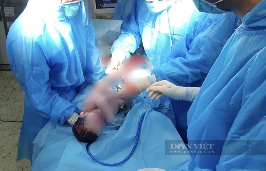Ca nhiễm Covid-19 liên tục đạt &quot;đỉnh&quot;, bác sĩ cảnh báo đối tượng đặc biệt nguy hiểm nếu không tiêm vaccine  - Ảnh 3.