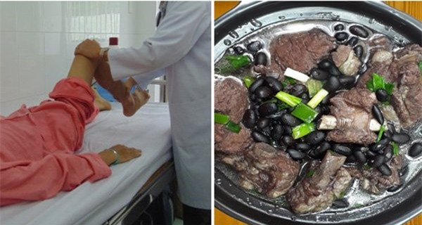 5 món canh tốt cho người loãng xương, giòn xương - Ảnh 1.
