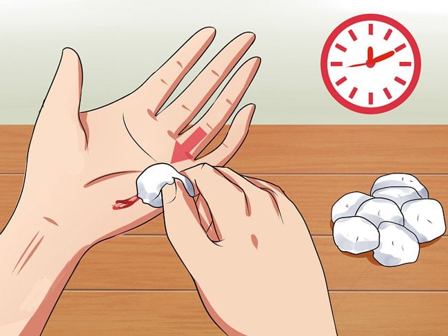 Bé trai 4 tuổi 3 lần xuất huyết não, 2 tháng đi viện 1 lần vì mắc bệnh Hemophilia  - Ảnh 5.