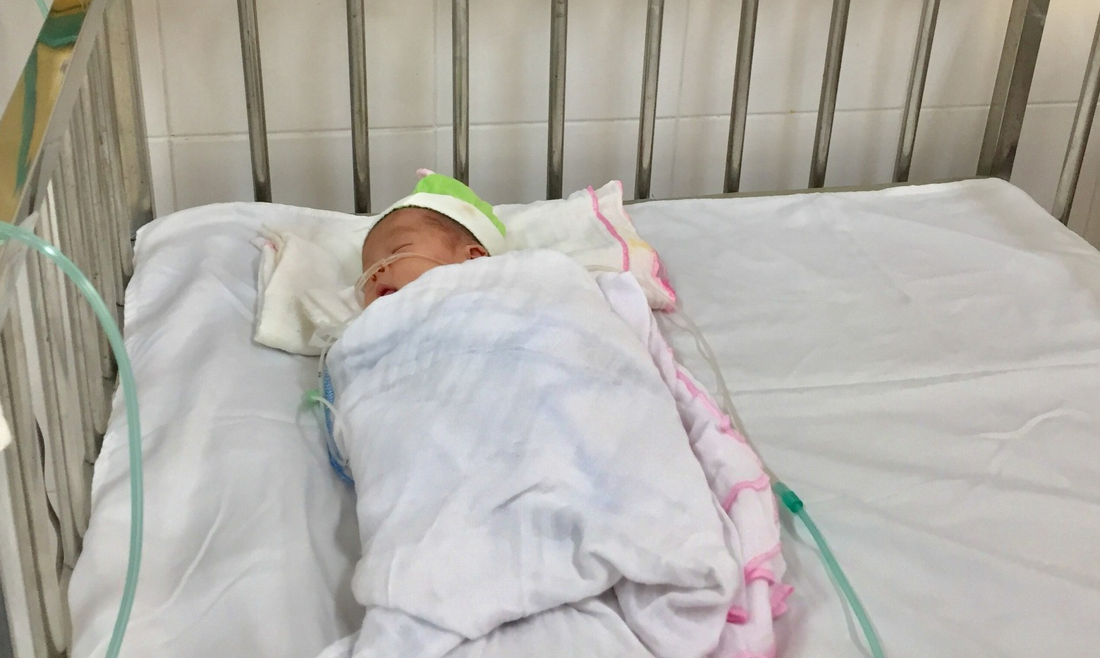 Đẻ tại nhà, một bé sơ sinh bị uốn ván rốn, nguy kịch - Ảnh 1.