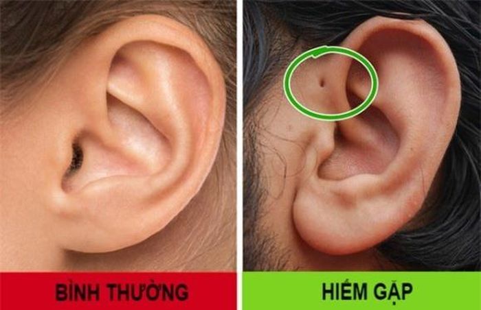 8 điểm đặc biệt rất ít người trên thế giới có: Bạn có mấy điểm? - Ảnh 3.