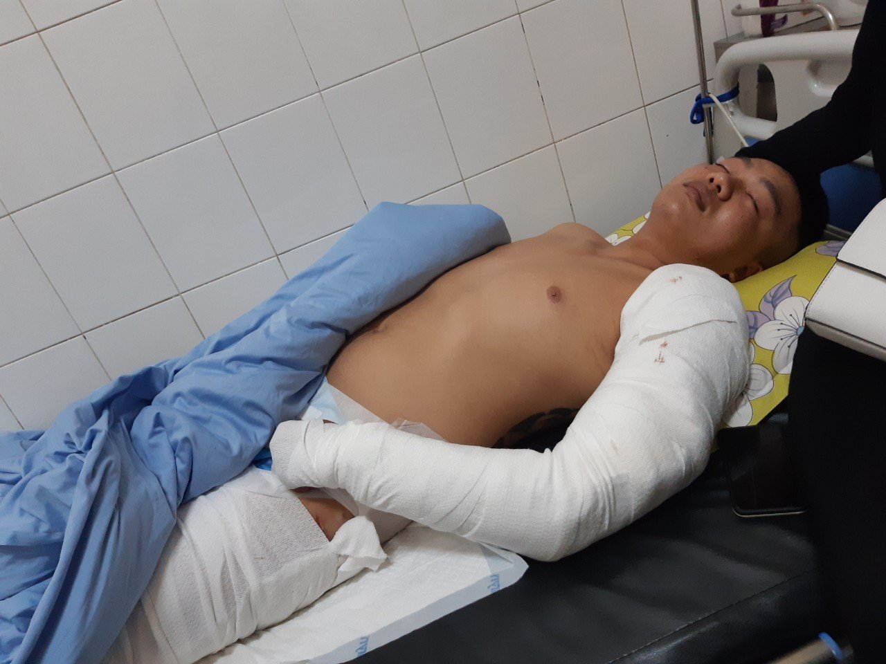 Lâm Đồng: Truy tìm nghi can 22 tuổi cầm đầu nhóm chém người dã man tại TP.Đà Lạt - Ảnh 4.