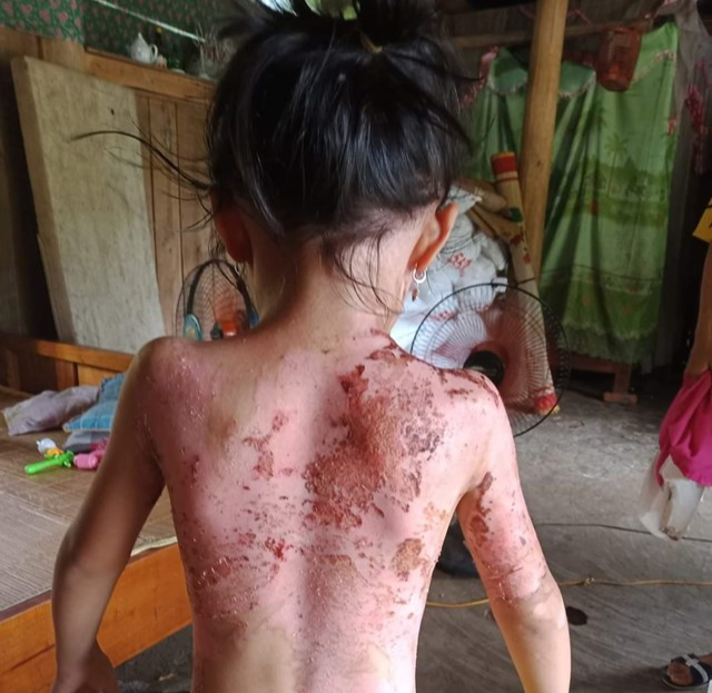 Kẻ dội cả ấm nước sôi lên người cháu bé ở Phú Thọ có thể bị xử lý thế nào? - Ảnh 1.