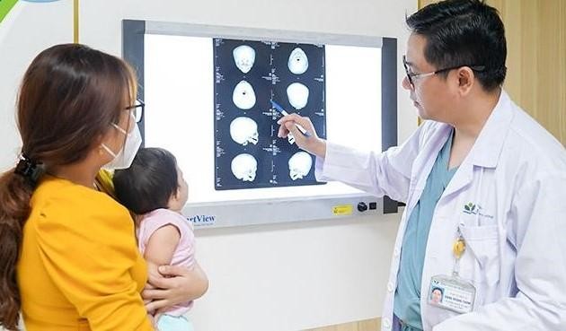 &quot;Tìm lại&quot; gương mặt cho bé gái 10 tháng tuổi bị dị tật sọ mặt hiếm gặp - Ảnh 1.