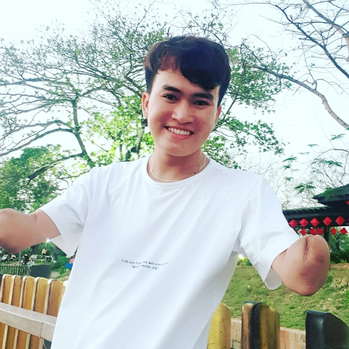 Chàng thợ hàn tìm ra lẽ sống sau tai nạn - Ảnh 2.
