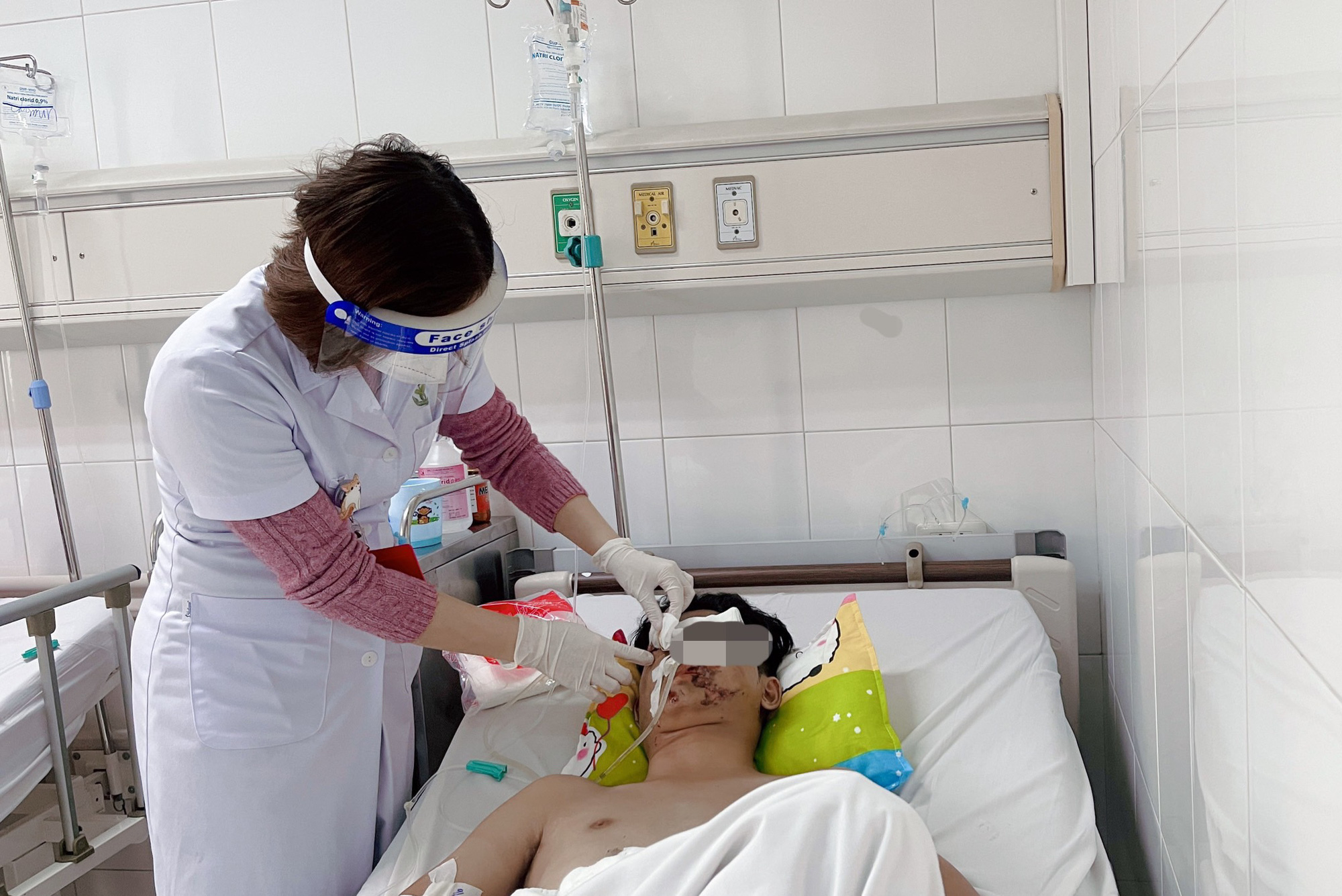 Tết Quý Mão, 377 ca tai nạn do pháo nổ nhập viện - Ảnh 1.