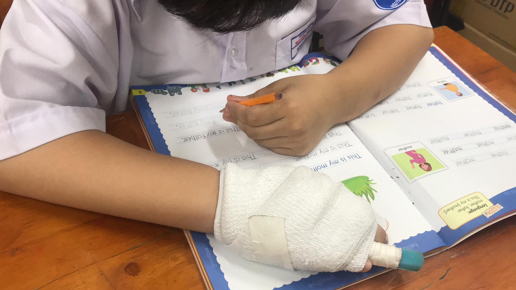 Vụ học sinh bị gãy ngón tay, Sở GDĐT TP.HCM nói gì? - Ảnh 3.