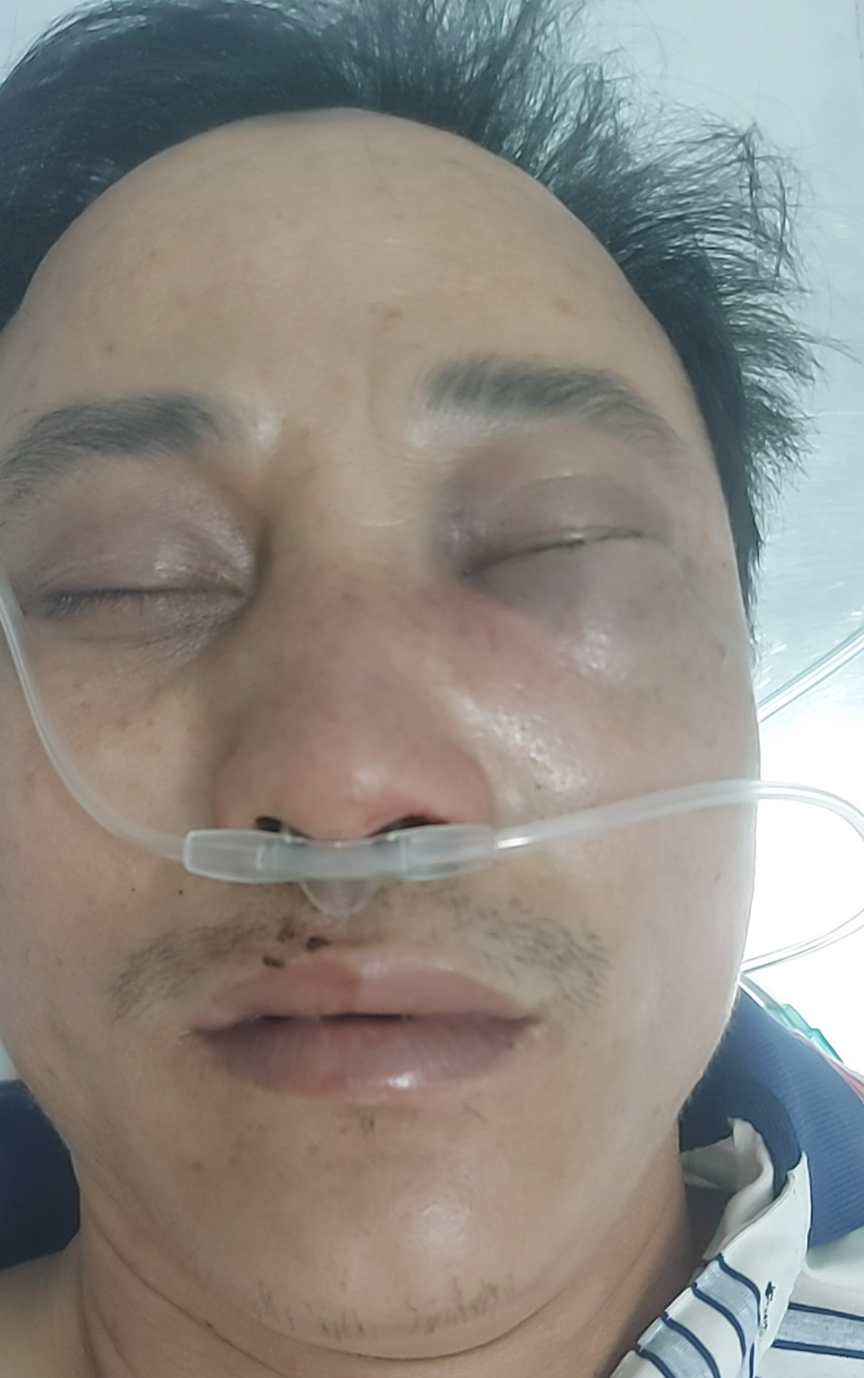 Công an truy bắt đối tượng đánh một thầy Hiệu phó đến gãy sống mũi ở Bình Thuận  - Ảnh 1.