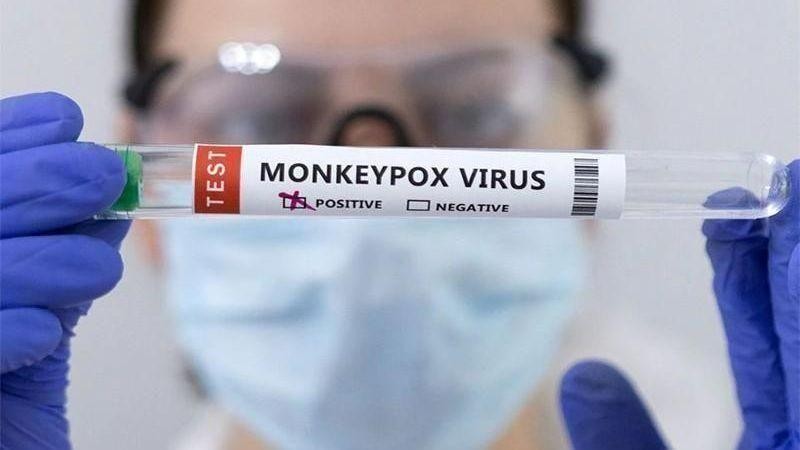 TP.HCM: 18/20 ca đậu mùa khỉ nhiễm HIV - Ảnh 1.