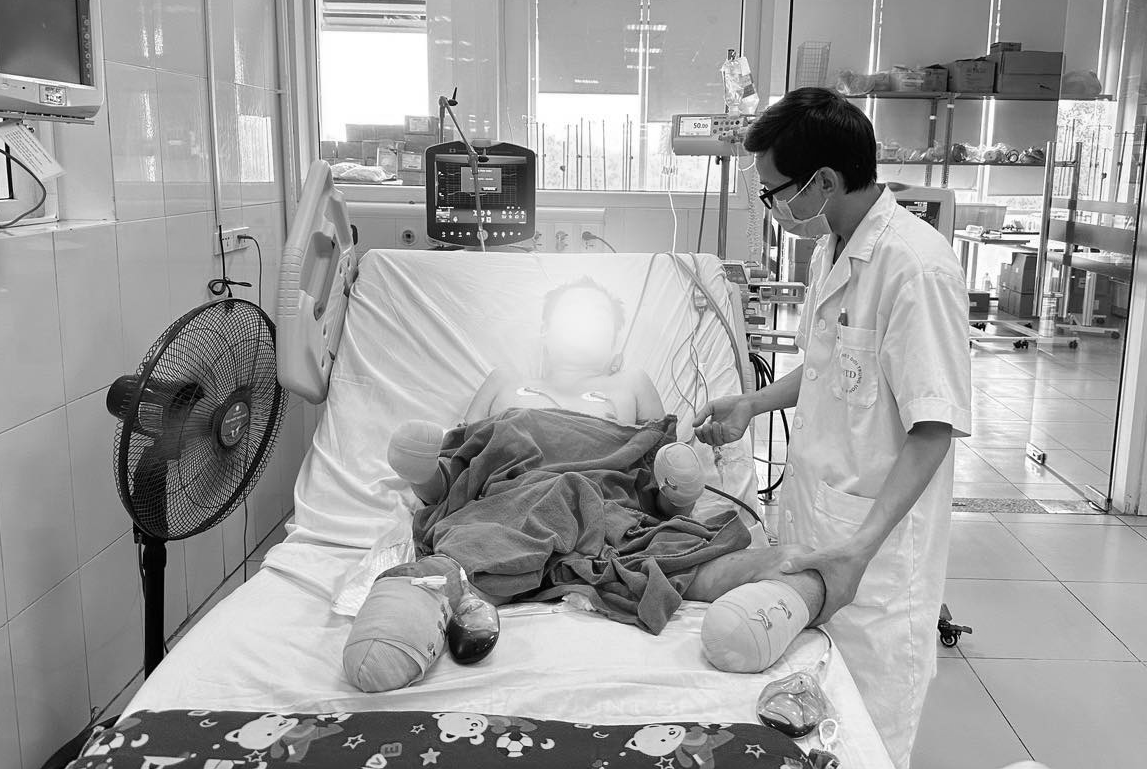 Ăn 1 miếng dồi lợn, người đàn ông mắc liên cầu lợn, phải cắt bỏ 2 bàn chân và một phần bàn tay - Ảnh 3.