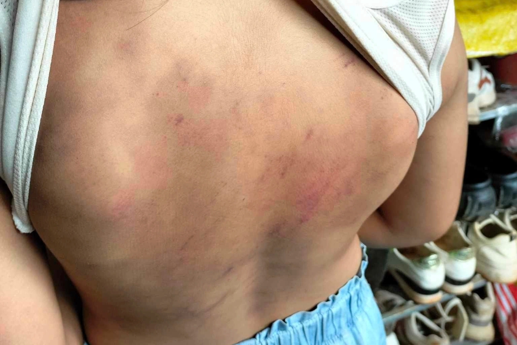 Chủ tịch huyện chỉ đạo xử lý nghiêm vụ nữ sinh bị 10 bạn đánh dã man - Ảnh 2.