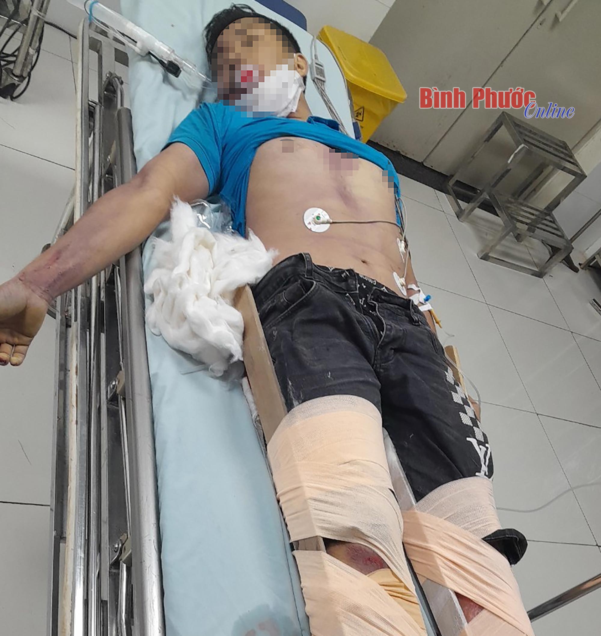 Nam thanh niên vào bệnh viện nhảy lầu tự sát, tử vong - Ảnh 2.