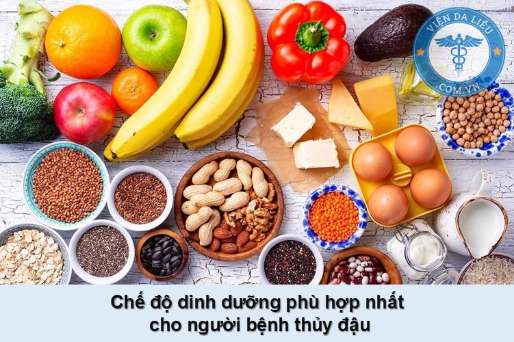Bệnh thủy đậu kiêng gì để nhanh khỏi và giải pháp từ gel Subạc - Ảnh 1.