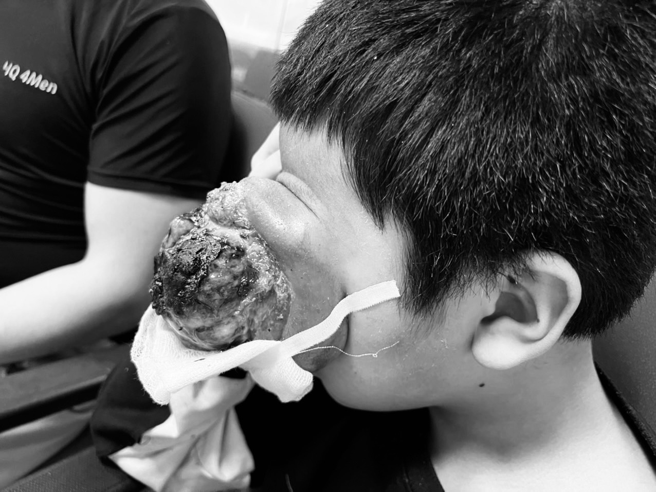 U quái khiến cậu bé 4 tuổi khóc ròng từ sáng đến đêm - Ảnh 1.