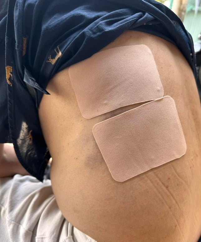 Nghệ sĩ Tấn Beo bất tỉnh sau khi rơi tự do xuống cầu thang - Ảnh 1.