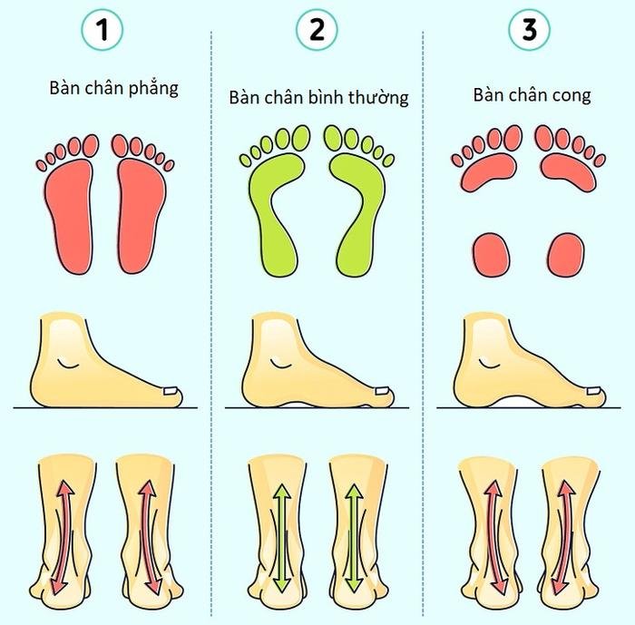 10 sai lầm khi mua giày dép khiến chân đau đớn - Ảnh 2.